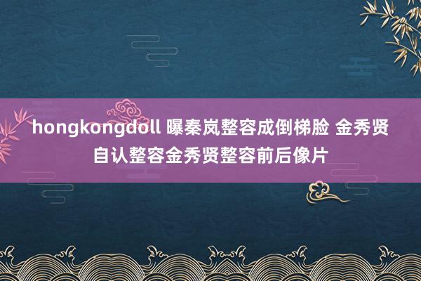 hongkongdoll 曝秦岚整容成倒梯脸 金秀贤自认整容金秀贤整容前后像片